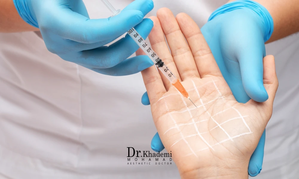 تزریق بوتاکس به کف دست