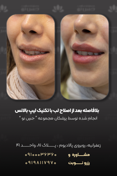 بعد از اصلاح فرم لب