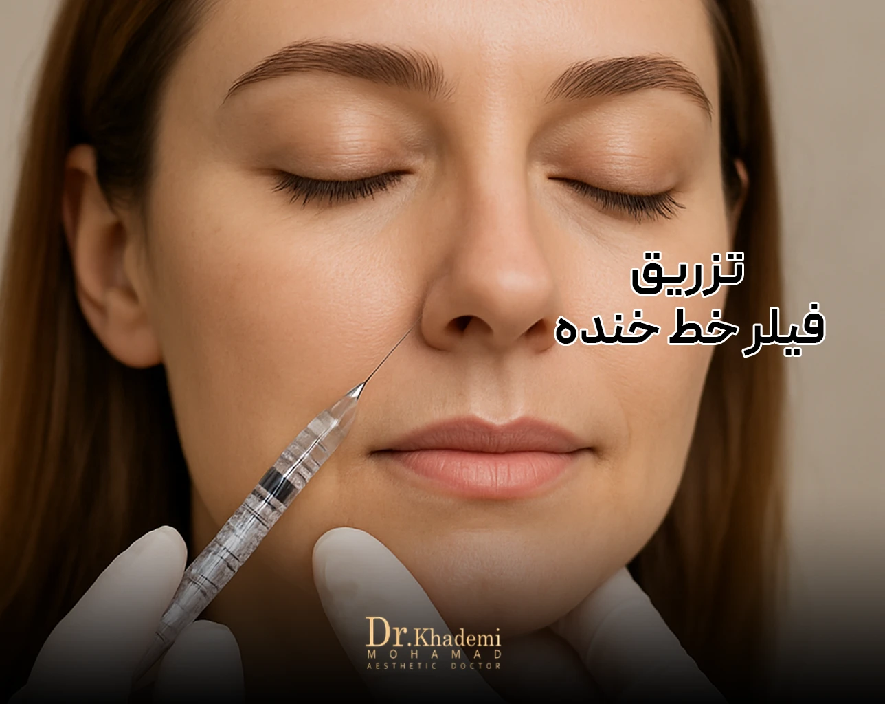 تصویر صورت یک خانم است که چشمهایش را بسته است در حالیکه آقای دکتر فیلر خط خنده تزریق می کند - تزریق فیلر خط خنده