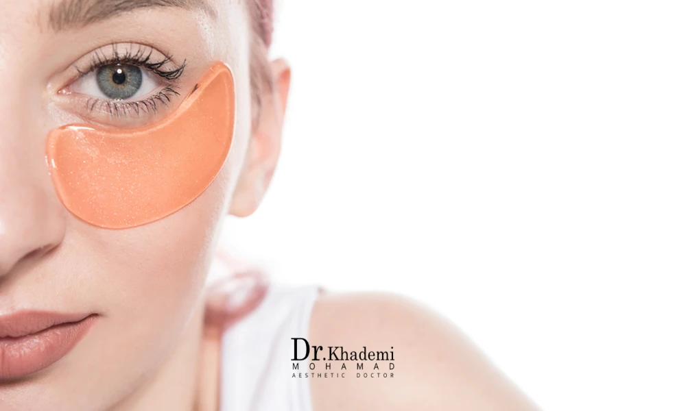 درمان ورم زیر چشم بعد از تزری فیلر یک خانم با ماسک