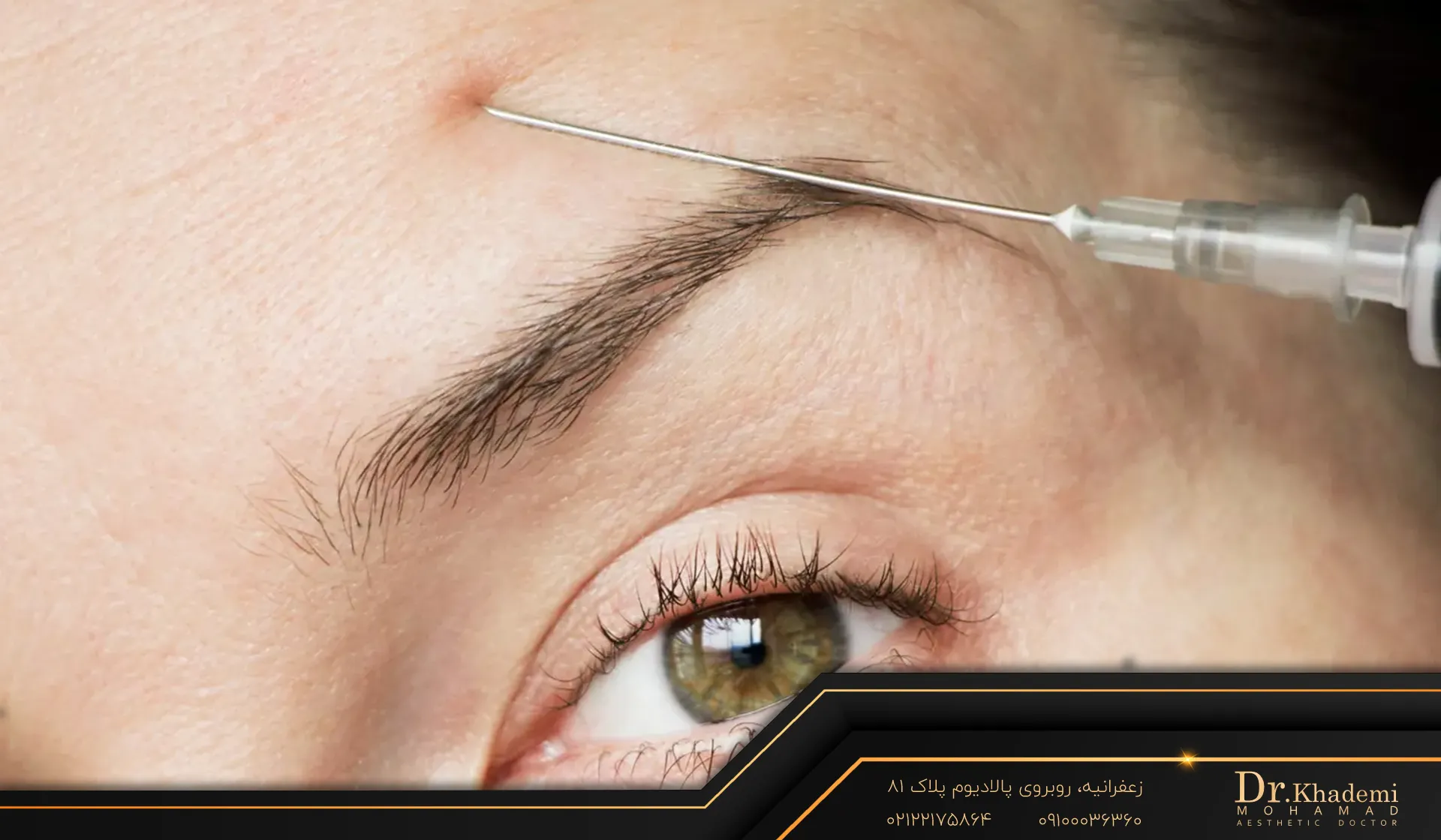 فردی که توسط پزشک در حال تزریق بوتاکس در ناحیه پیشانی میباشد