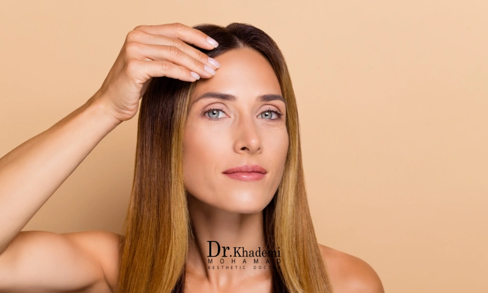 یک خانم بعد از انجام و گذراندن دوره تقاهت لیفت پیشانی با نخ