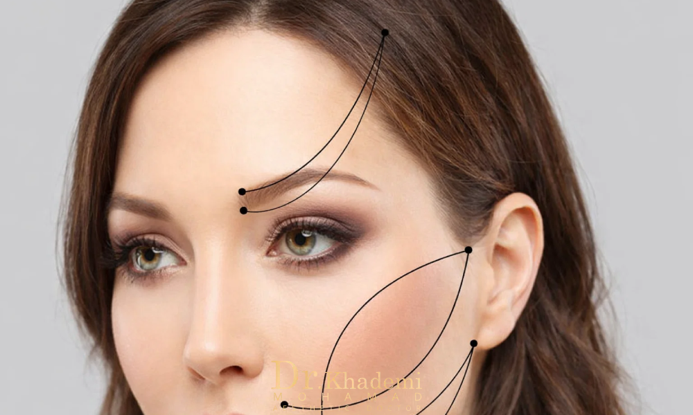 لیفت پیشانی با انواع نخ