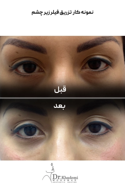 sample khademi (1) (1) (1)