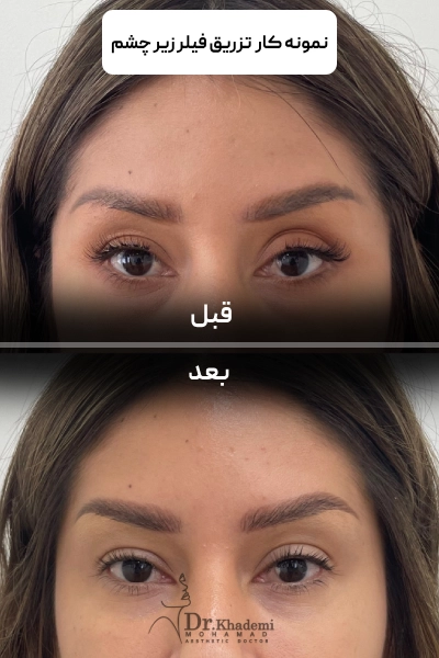 sample khademi (1) (1)